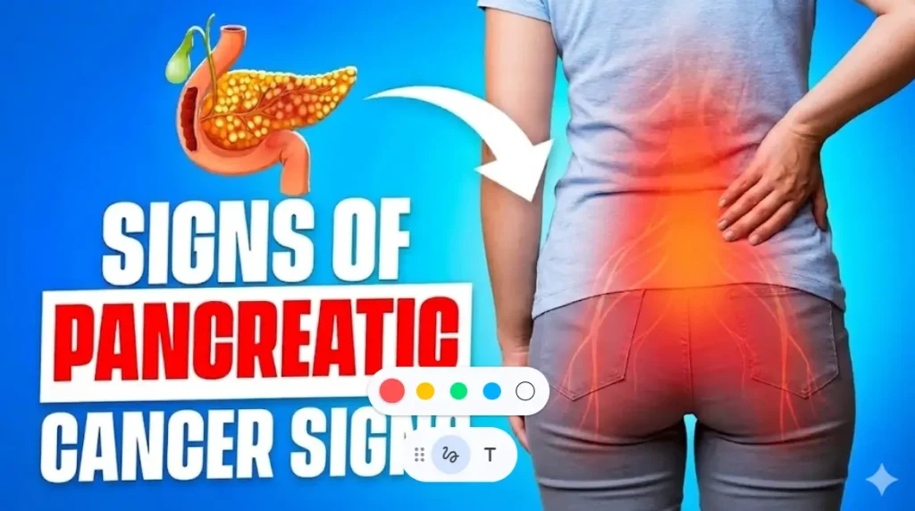 10 Early Warning Signs of Pancreatic Cancer You Need to Know