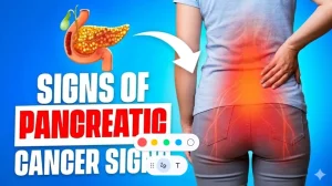 10 Early Warning Signs of Pancreatic Cancer You Need to Know